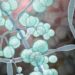 Candida Auris