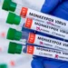 mpox monkeypox mpox-cases mpox-deaths monkeypox-outbreak clade-Ib-MPXV Mpox transmission Mpox symptoms World Health Organizatio
