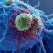 Gynecologic Cancer,gynecologic cancer radiation treatment,healthy tissue,gynecologic cancer treatment,radiation therapy