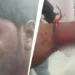 Police control scene at Koppal after mob attack on Hindu man